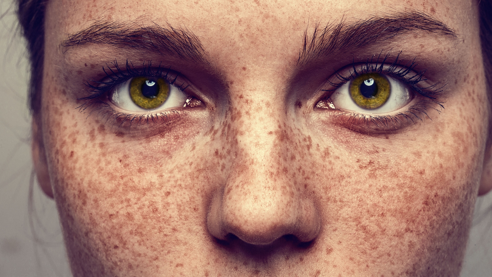 Pigmentflecken: Was wirklich dagegen hilft