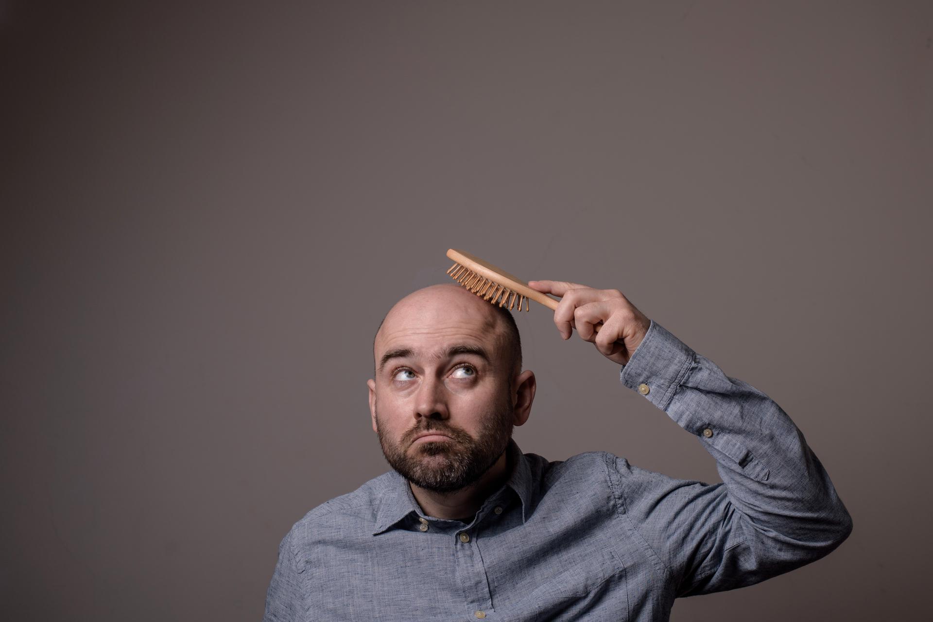 haarausfall - Haarausfall: Vor allem Männer leiden darunter, dass die Haare weniger werden.